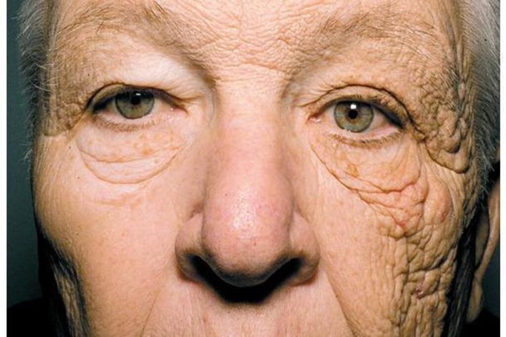 The impact of 28 years of sun exposure on your