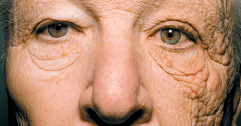 Years of Sun Exposure: A Truck Driver's Skin Transformation